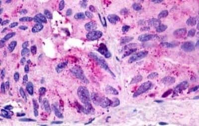 Immunohistochemistry: GPR21 Antibody [NBP3-14354]